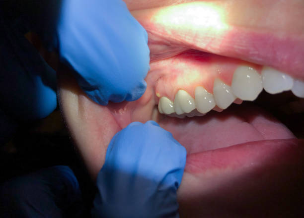 After-Hours Dental Trauma Care